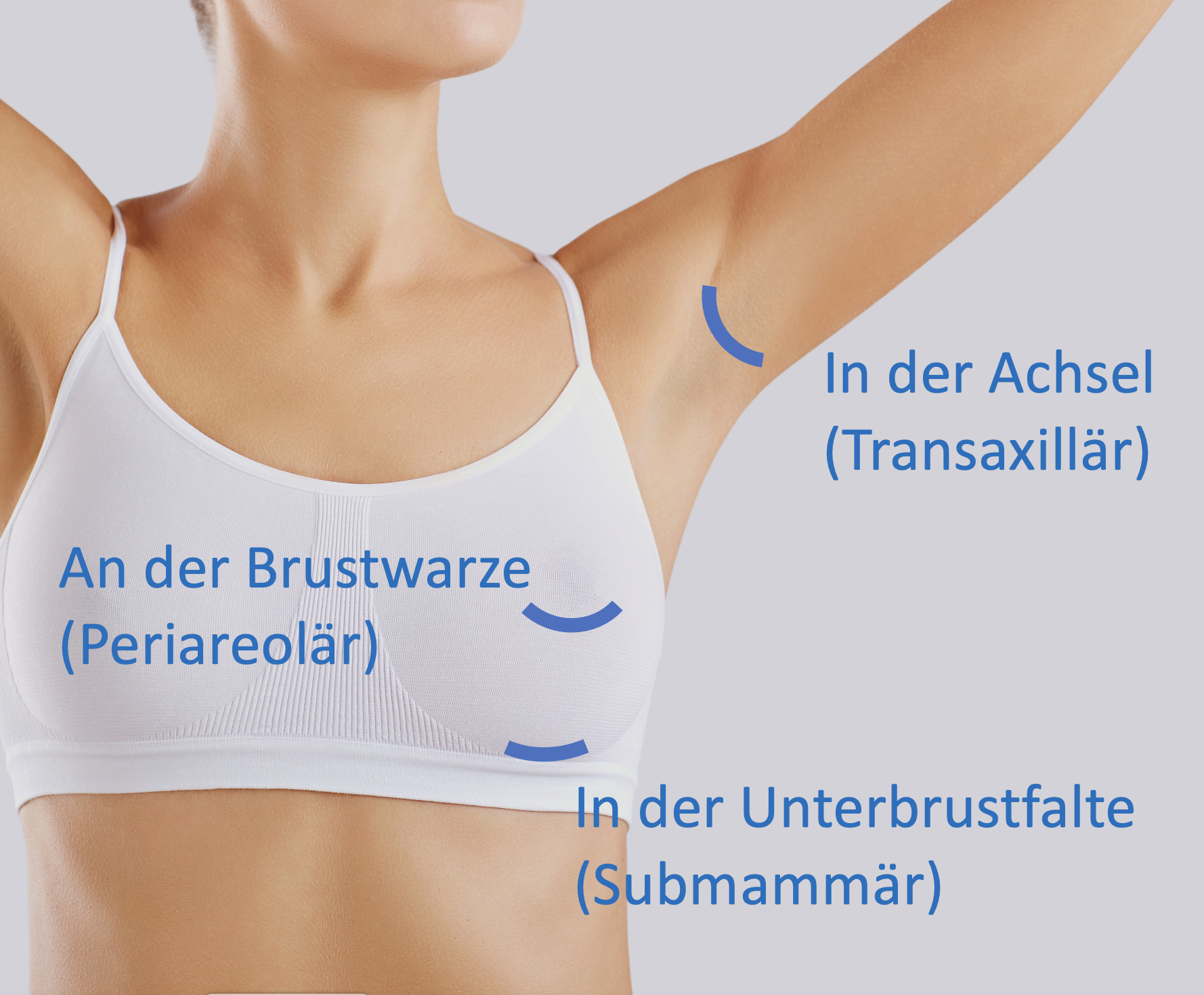 Zugangswege zur Brustvergrößerung